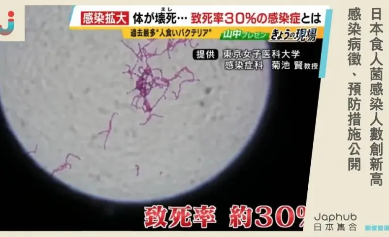 食人菌 — TW news