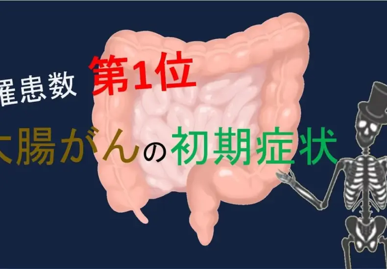 大腸癌 — TW news